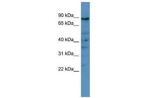 PDE8A antibody used at 0. (PDE8A 抗体  (C-Term))