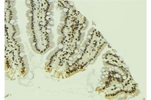 ABIN6267241 at 1/100 staining Mouse colon tissue by IHC-P. (JAK2 抗体  (pTyr931))
