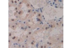 IHC-P analysis of Kidney tissue, with DAB staining. (Mre11 抗体  (AA 375-609))