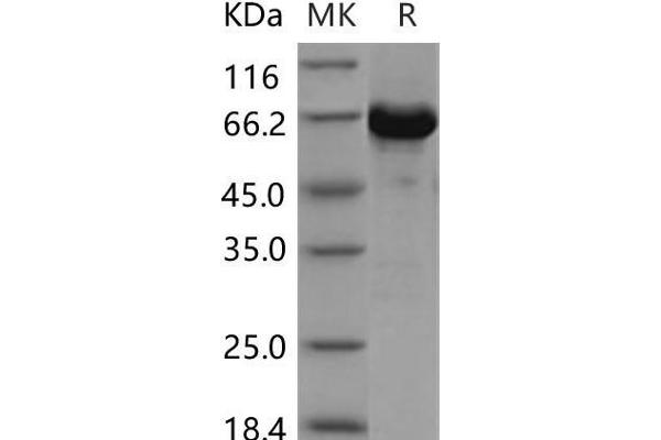 AKT3 Protein (AA 106-479) (GST tag,His tag)