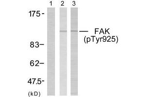 Western blot analysis of extracts using FAK (phospho- Tyr925) antibody (E011123). (FAK 抗体  (pTyr925))