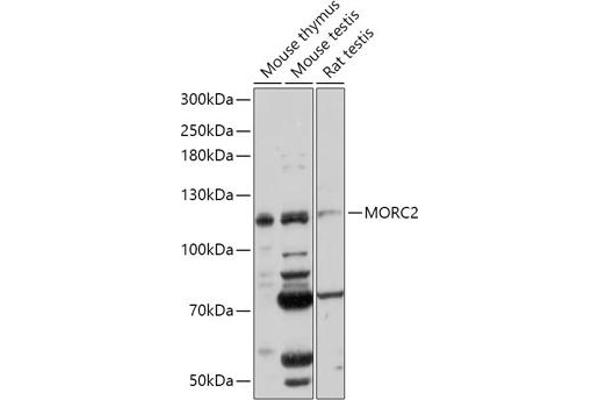 MORC2 抗体  (AA 60-250)
