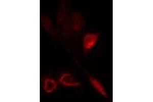 ABIN6275795 staining  HeLa cells by IF/ICC. (ANAPC5 抗体  (Internal Region))