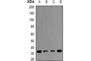 Western blot analysis of ERP29 expression in THP1 (A), Hela (B), mouse testis (C), mouse spleen (D) whole cell lysates. (ERP29 抗体)