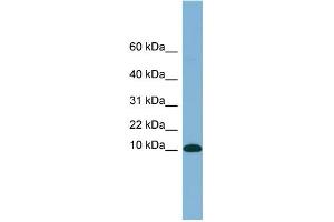 WB Suggested Anti-B2M Antibody Titration: 0. (beta-2 Microglobulin 抗体  (N-Term))