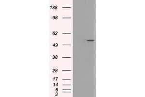 Western Blotting (WB) image for anti-Solute Carrier Family 2 (Facilitated Glucose/fructose Transporter), Member 5 (SLC2A5) antibody (ABIN1498476) (SLC2A5 抗体)