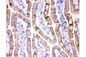 IHC(F) staining of rat intestine tissue (JUP 抗体  (AA 556-745))