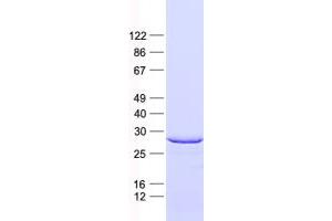 Validation with Western Blot (Stanniocalcin 1 Protein (STC1) (His tag))