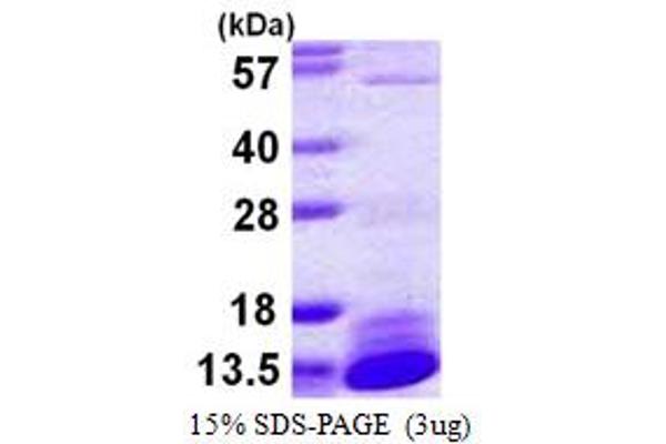 DYNLL2 Protein (AA 1-89) (His tag)