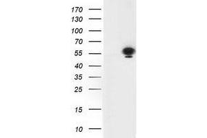 HEK293T cells were transfected with the pCMV6-ENTRY control (Left lane) or pCMV6-ENTRY TP53 (Right lane) cDNA for 48 hrs and lysed. (p53 抗体)