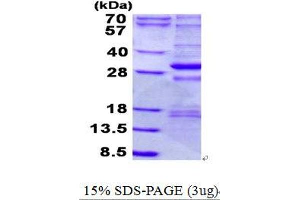 NDUFS3 Protein (His tag)