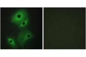Immunofluorescence analysis of HeLa cells, using NBL1 Antibody. (NBL1 抗体  (AA 131-180))