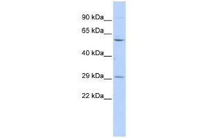 WB Suggested Anti-TRIM62 Antibody Titration:  0. (TRIM62 抗体  (Middle Region))