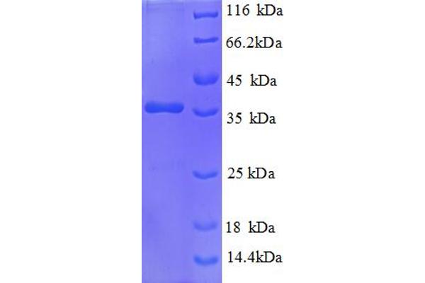 HSBP1 Protein (AA 1-75, partial) (GST tag)