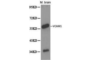 Western Blotting (WB) image for anti-Vascular Cell Adhesion Molecule 1 (VCAM1) antibody (ABIN1875313) (VCAM1 抗体)