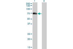 Western Blotting (WB) image for anti-A Kinase (PRKA) Anchor Protein 10 (AKAP10) (AA 1-100) antibody (ABIN564879)