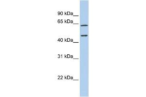 WB Suggested Anti-CECR1 Antibody Titration:  0. (CECR1 抗体  (N-Term))