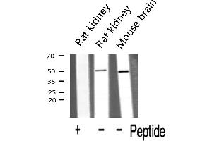 Western blot analysis of HDAC3 expression in various lysates (HDAC3 抗体  (C-Term))