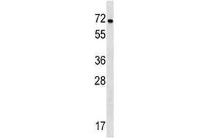 NOX1 antibody western blot analysis in WiDr lysate. (NOX1 抗体  (AA 243-271))