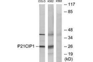Western blot analysis of extracts from COLO/K562 cells, treated with EGF, using p21 Cip1 (Ab-145) Antibody. (p21 抗体  (AA 111-160))