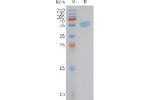 Human I Protein, hFc Tag on SDS-PAGE under reducing condition. (IFNA2 Protein (AA 24-188) (Fc Tag))