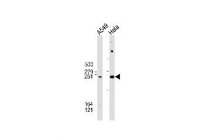 Western Blot at 1:2000 dilution Lane 1: A549 whole cell lysate Lane 2: Hela whole cell lysate Lysates/proteins at 20 ug per lane. (WNK1 抗体  (AA 1848-1882))