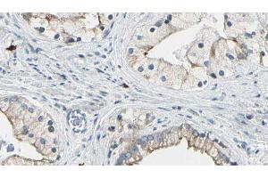 ABIN6277728 at 1/100 staining Human prostate tissue by IHC-P. (DVL1 抗体)