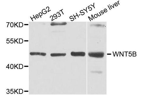 WNT5B 抗体  (AA 120-359)