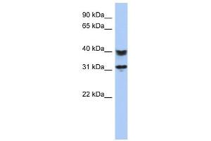 C5ORF35 antibody used at 1 ug/ml to detect target protein. (C5orf35 抗体  (N-Term))