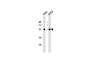 All lanes : Anti-IRAK4 Antibody (N-term) at 1:1000 dilution Lane 1: Hela whole cell lysate Lane 2: K562 whole cell lysate Lysates/proteins at 20 μg per lane. (IRAK4 抗体  (N-Term))