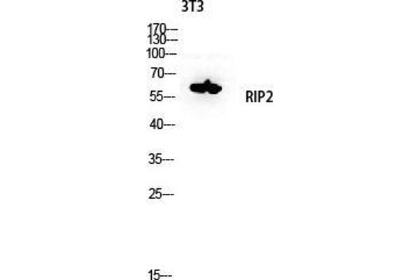 RIP2 抗体  (Tyr397)