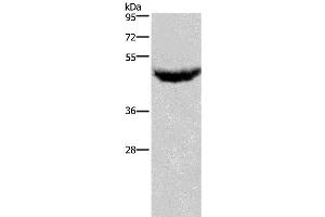 Western Blotting (WB) image for anti-Chemokine (C-X-C Motif) Receptor 2 (CXCR2) antibody (ABIN2431222) (CXCR2 抗体)