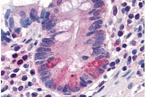 Human Small Intestine, Paneth Cells (formalin-fixed, paraffin-embedded) stained with SLC15A1 antibody ABIN290274 at 20 ug/ml followed by biotinylated goat anti-rabbit IgG secondary antibody ABIN481713, alkaline phosphatase-streptavidin and chromogen. (SLC15A1 抗体  (C-Term))