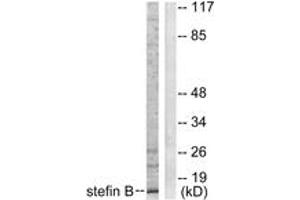 Western Blotting (WB) image for anti-Cystatin B (Stefin B) (CSTB) (AA 49-98) antibody (ABIN2889258) (CSTB 抗体  (AA 49-98))