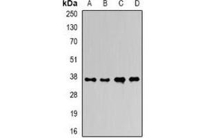 Western blot analysis of Ficolin 1 expression in HepG2 (A), mouse liver (B), mouse heart (C), rat liver (D) whole cell lysates. (FCN1 抗体)