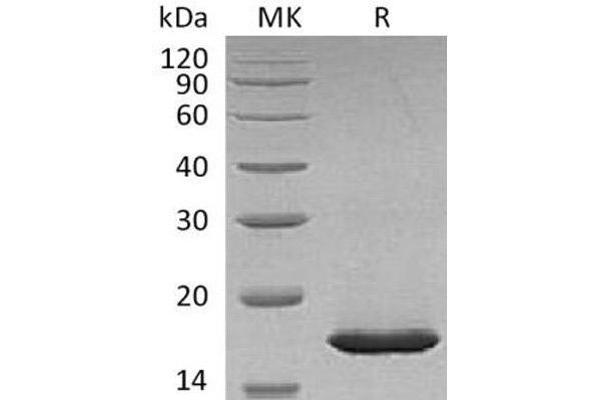 Leptin Protein (LEP) (His tag)