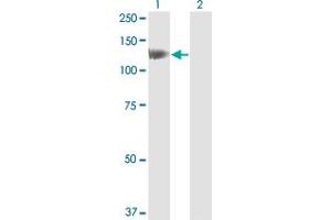 Western Blotting (WB) image for anti-Huntingtin Interacting Protein 1 (HIP1) (AA 928-1037) antibody (ABIN561263)