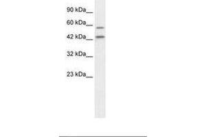 Image no. 2 for anti-Autophagy related 4B Cysteine Peptidase (ATG4B) (C-Term) antibody (ABIN6735868) (ATG4B 抗体  (C-Term))