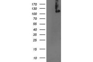 HEK293T cells were transfected with the pCMV6-ENTRY control (Left lane) or pCMV6-ENTRY ERCC4 (Right lane) cDNA for 48 hrs and lysed. (ERCC4 抗体)