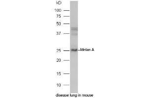 Mouse lung lysate probed with Rabbit Anti-Melan A Polyclonal Antibody, Unconjugated (ABIN2559583) at 1:300 in 4˚C. (MLANA 抗体  (AA 1-80))