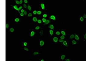 Immunofluorescence staining of Hela cells with ABIN7139604 at 1:2. (HIST1H4A 抗体  (meLys5))