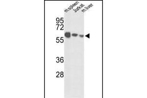 Western blot analysis of IGFALS Antibody (Center) (ABIN391690 and ABIN2841595) in mouse spleen tissue, Jurkat cell line and mouse liver tissue lysates (35 μg/lane). (IGFALS 抗体  (AA 308-335))
