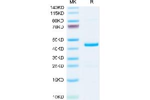 AIMP1 Protein (AA 2-310) (His tag)