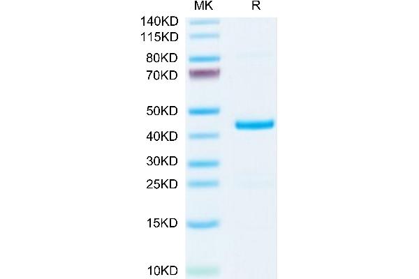 AIMP1 Protein (AA 2-310) (His tag)