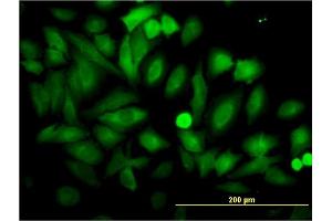 Immunofluorescence (IF) image for anti-Enolase 1 (ENO1) (AA 1-434) antibody (ABIN560741)