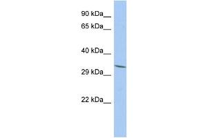 WB Suggested Anti-FAM78A Antibody Titration: 0. (FAM78A 抗体  (N-Term))
