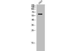 Western Blot analysis of COLO cells using Phospho-c-Src (S75) Polyclonal Antibody (Src 抗体  (pSer75))