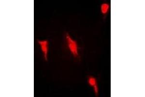 Immunofluorescent analysis of PRMT2 staining in Hela cells. (PRMT2 抗体)