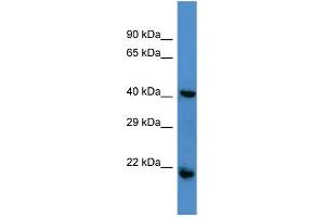 Host:  Rabbit  Target Name:  RGS7  Sample Type:  Jurkat Whole cell lysates  Antibody Dilution:  1. (RGS7 抗体  (N-Term))