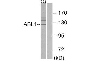 Immunohistochemistry analysis of paraffin-embedded human brain tissue using ABL1 antibody. (ABL1 抗体  (Internal Region))